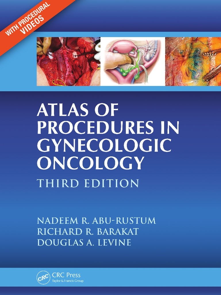 Atlas of procedures in gynecologic oncology