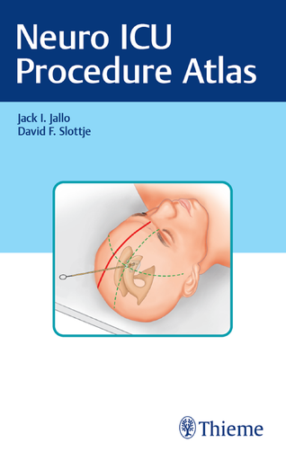 [2407202325451] Neuro ICU Procedure Atlas