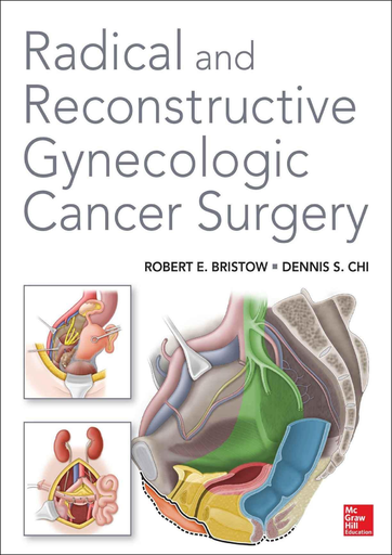 [2707202328517] Radical and Reconstructive Gynecologic Cancer Surgery