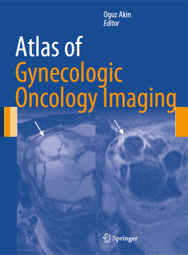 [2707202330322] Atlas of Gynecologic Oncology Imaging