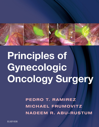[29072023125653] Principles of Gynecologic Oncology Surgery