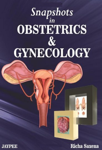 [2407202316495] Snapshots in Obstetrics and Gynecology